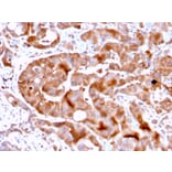 Immunohistochemistry - Anti-FABP5 Antibody [FABP5/3750] - BSA and Azide free (A251707) - Antibodies.com