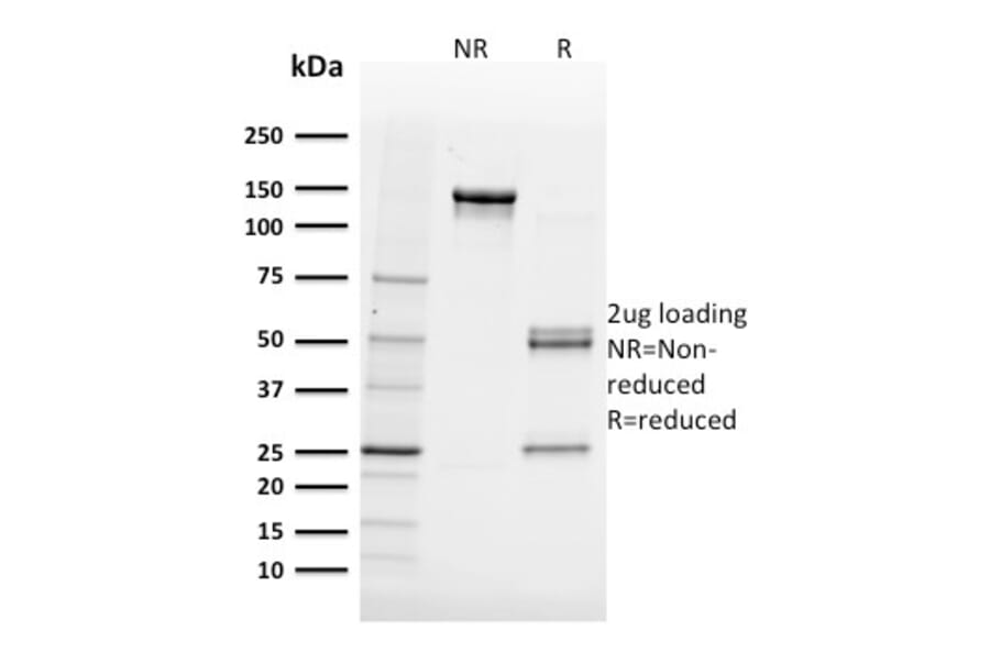 SDS-PAGE - Anti-FABP5 Antibody [FABP5/3750] - BSA and Azide free (A251707) - Antibodies.com