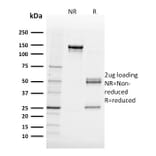 SDS-PAGE - Anti-FABP5 Antibody [FABP5/3750] - BSA and Azide free (A251707) - Antibodies.com