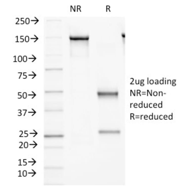 SDS-PAGE - Anti-FAT2 Antibody [8C5] - BSA and Azide free (A251710) - Antibodies.com