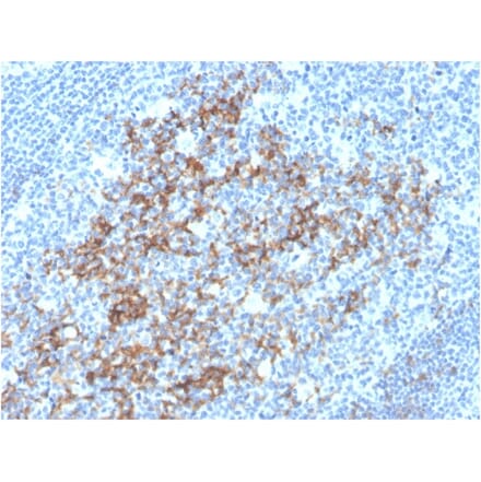 Immunohistochemistry - Anti-CD23 Antibody [FCER2/3592] - BSA and Azide free (A251711) - Antibodies.com