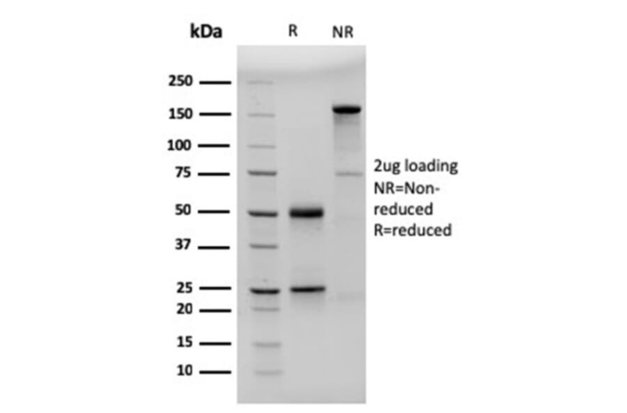 SDS-PAGE - Anti-CD23 Antibody [FCER2/3592] - BSA and Azide free (A251711) - Antibodies.com