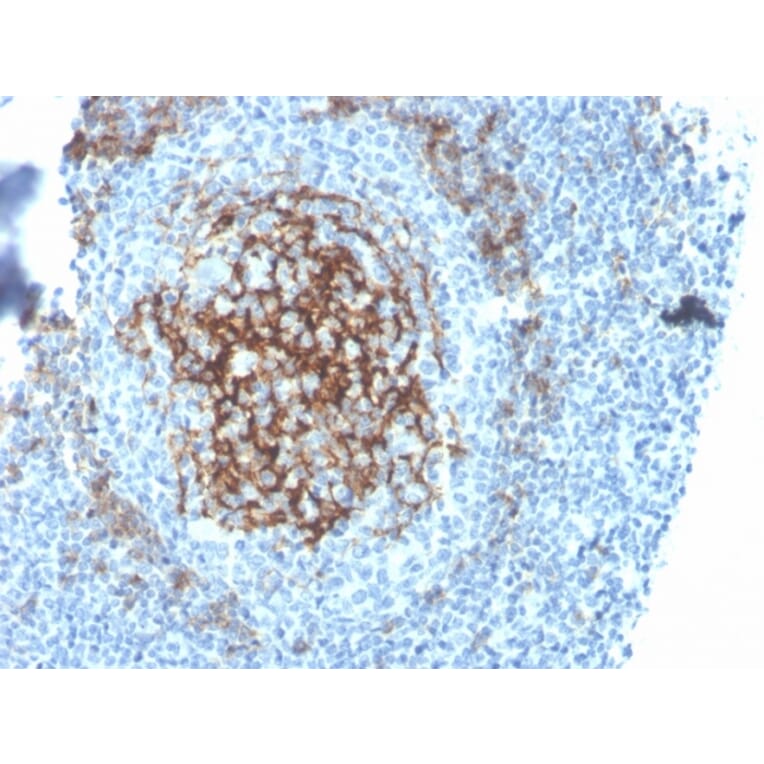Immunohistochemistry - Anti-CD23 Antibody [FCER2/4395R] - BSA and Azide free (A251712) - Antibodies.com