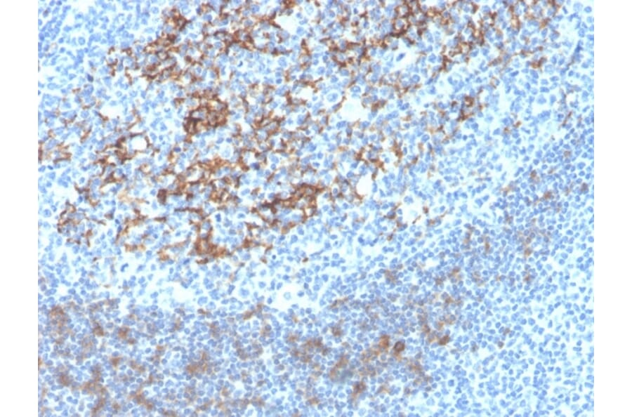Immunohistochemistry - Anti-CD23 Antibody [FCER2/4395R] - BSA and Azide free (A251711) - Antibodies.com