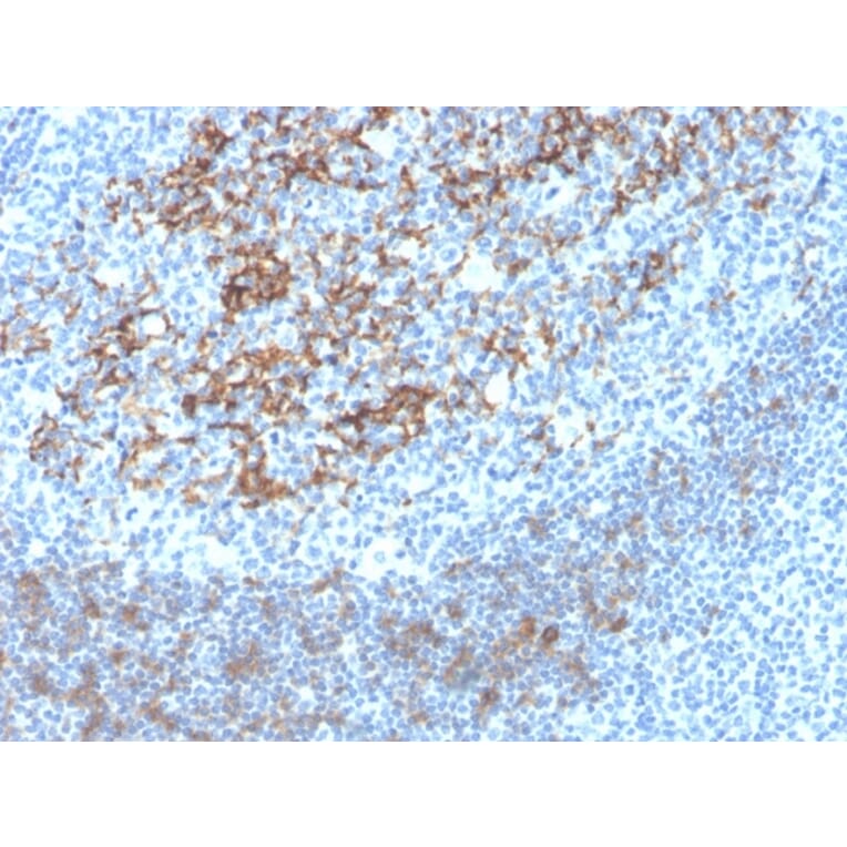 Immunohistochemistry - Anti-CD23 Antibody [FCER2/4395R] - BSA and Azide free (A251711) - Antibodies.com