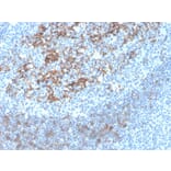 Immunohistochemistry - Anti-CD23 Antibody [FCER2/4395R] - BSA and Azide free (A251711) - Antibodies.com