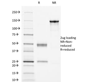 SDS-PAGE - Anti-CD16 Antibody [HuNK2] - BSA and Azide free (A251716) - Antibodies.com