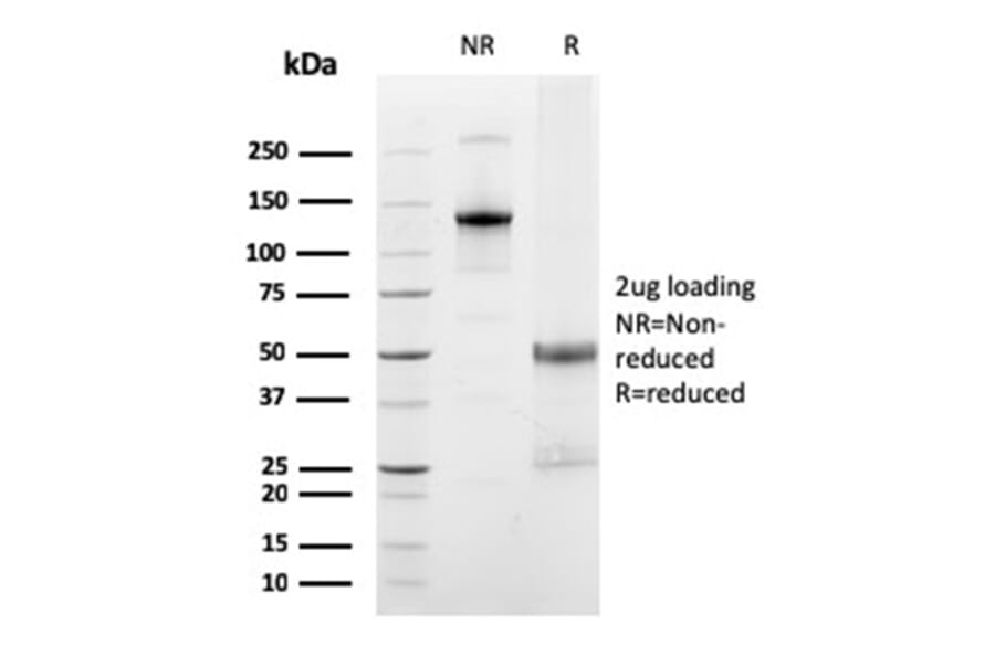 SDS-PAGE - Anti-FCGRT Antibody [FCGRT/2932] - BSA and Azide free (A251720) - Antibodies.com