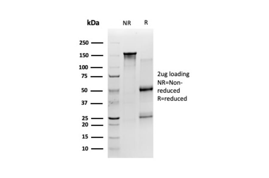 SDS-PAGE - Anti-SIRT2 Antibody [PCRP-SIRT2-1A8] - BSA and Azide free (A251722) - Antibodies.com
