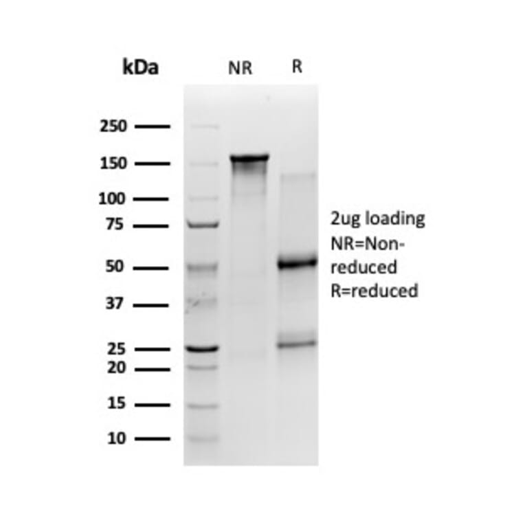 SDS-PAGE - Anti-SIRT2 Antibody [PCRP-SIRT2-1A8] - BSA and Azide free (A251722) - Antibodies.com