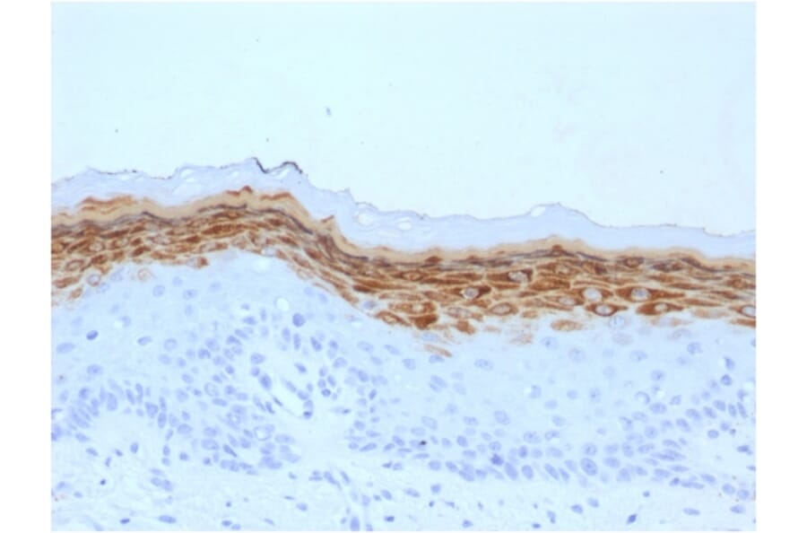 Immunohistochemistry - Anti-Filaggrin Antibody [FLG/1561] - BSA and Azide free (A251725) - Antibodies.com