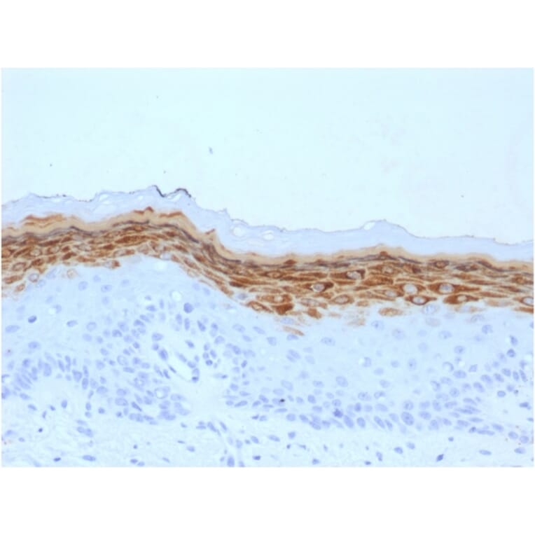 Immunohistochemistry - Anti-Filaggrin Antibody [FLG/1561] - BSA and Azide free (A251725) - Antibodies.com
