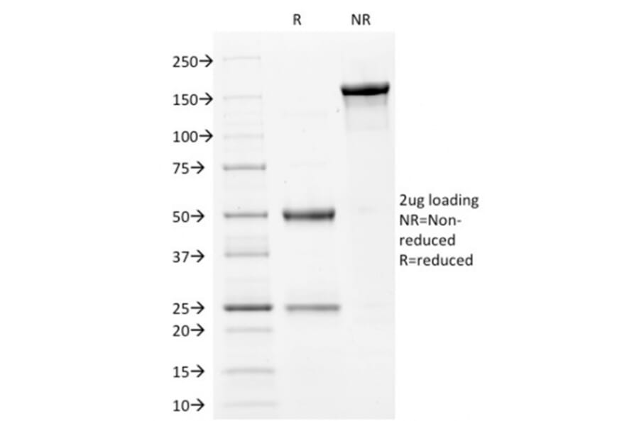 SDS-PAGE - Anti-Filaggrin Antibody [FLG/1561] - BSA and Azide free (A251725) - Antibodies.com