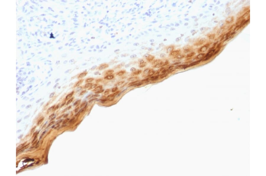 Immunohistochemistry - Anti-Filaggrin Antibody [SPM181] - BSA and Azide free (A251725) - Antibodies.com