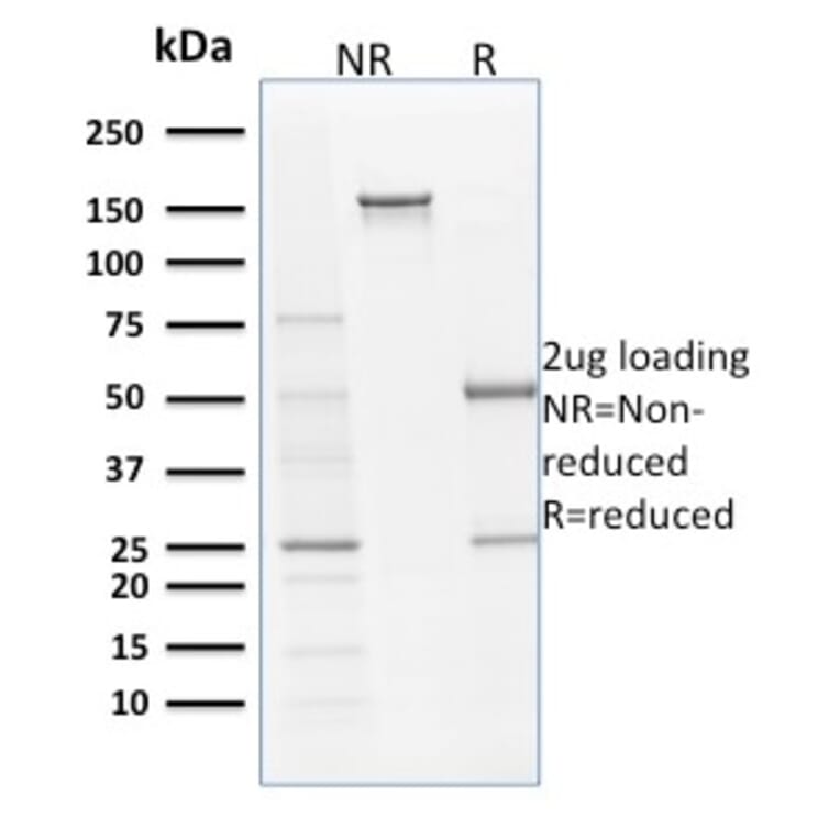 SDS-PAGE - Anti-Filaggrin Antibody [SPM181] - BSA and Azide free (A251726) - Antibodies.com