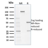 SDS-PAGE - Anti-Filaggrin Antibody [SPM181] - BSA and Azide free (A251726) - Antibodies.com