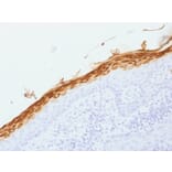 Immunohistochemistry - Anti-Filaggrin Antibody [FLG/1562] - BSA and Azide free (A251726) - Antibodies.com