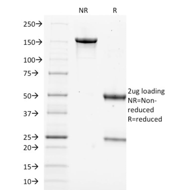 SDS-PAGE - Anti-Filaggrin Antibody [FLG/1562] - BSA and Azide free (A251727) - Antibodies.com