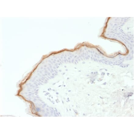 Immunohistochemistry - Anti-Filaggrin Antibody [FLG/1563] - BSA and Azide free (A251728) - Antibodies.com