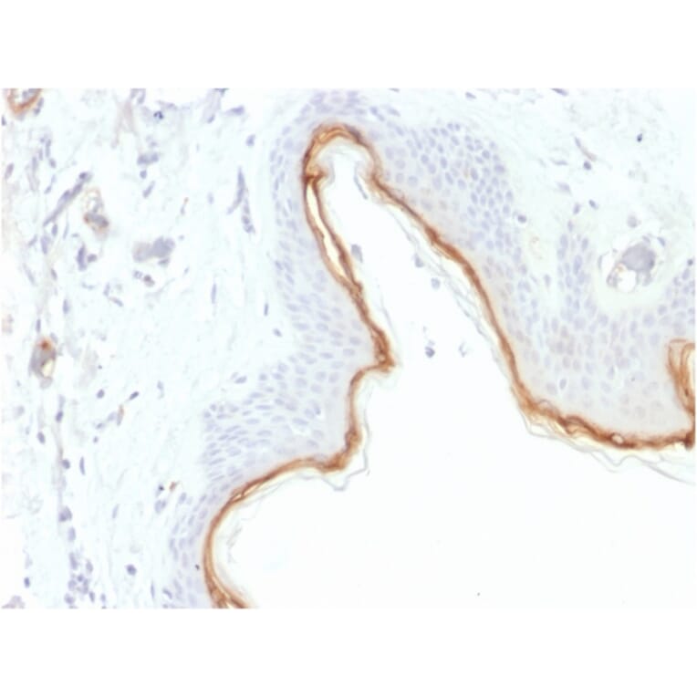 Immunohistochemistry - Anti-Filaggrin Antibody [FLG/1945] - BSA and Azide free (A251729) - Antibodies.com