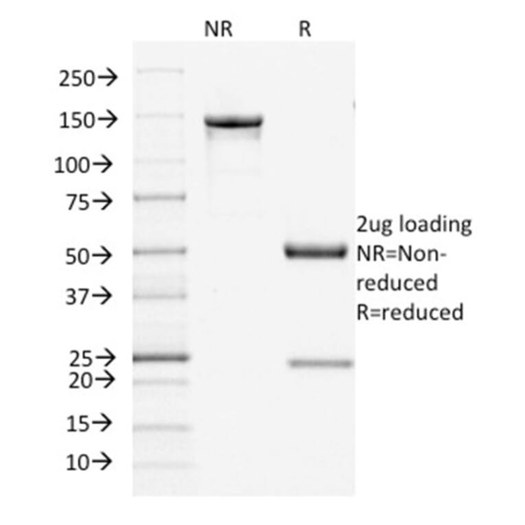 SDS-PAGE - Anti-Filaggrin Antibody [FLG/1945] - BSA and Azide free (A251729) - Antibodies.com