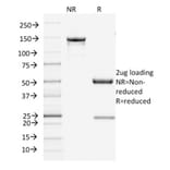 SDS-PAGE - Anti-Filaggrin Antibody [FLG/1945] - BSA and Azide free (A251729) - Antibodies.com
