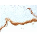 Immunohistochemistry - Anti-Filaggrin Antibody [rFLG/1561] - BSA and Azide free (A251729) - Antibodies.com