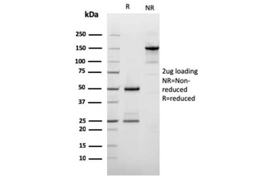 SDS-PAGE - Anti-Filaggrin Antibody [rFLG/1561] - BSA and Azide free (A251730) - Antibodies.com