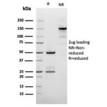 SDS-PAGE - Anti-Filaggrin Antibody [rFLG/1561] - BSA and Azide free (A251730) - Antibodies.com