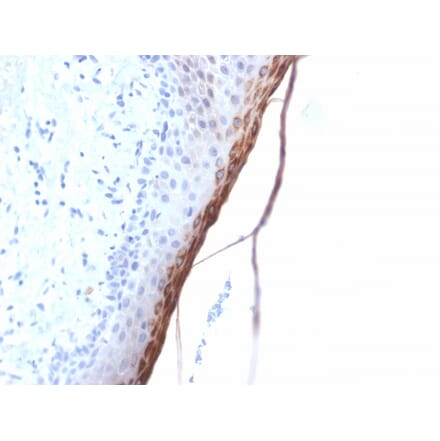 Immunohistochemistry - Anti-Filaggrin Antibody [FLG/1957R] - BSA and Azide free (A251730) - Antibodies.com