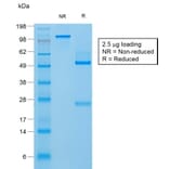 SDS-PAGE - Anti-Filaggrin Antibody [FLG/1957R] - BSA and Azide free (A251731) - Antibodies.com
