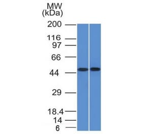 Western Blot - Anti-FLI1 Antibody [FLI1/1312] - BSA and Azide free (A251731) - Antibodies.com
