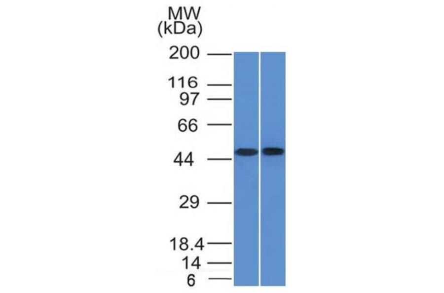 Western Blot - Anti-FLI1 Antibody [FLI1/1312] - BSA and Azide free (A251731) - Antibodies.com