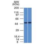 Western Blot - Anti-FLI1 Antibody [FLI1/1312] - BSA and Azide free (A251731) - Antibodies.com