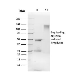 SDS-PAGE - Anti-FLI1 Antibody [FLI1/3183] - BSA and Azide free (A251733) - Antibodies.com
