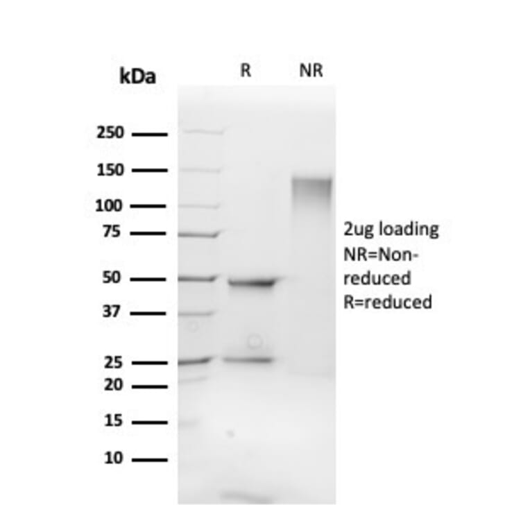 SDS-PAGE - Anti-FLI1 Antibody [FLI1/3183] - BSA and Azide free (A251733) - Antibodies.com