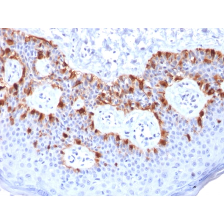 Immunohistochemistry - Anti-MelanA Antibody [rMLANA/788] - BSA and Azide free (A251733) - Antibodies.com
