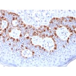 Immunohistochemistry - Anti-MelanA Antibody [rMLANA/788] - BSA and Azide free (A251733) - Antibodies.com