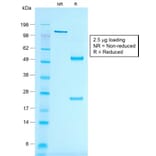 SDS-PAGE - Anti-MelanA Antibody [rMLANA/788] - BSA and Azide free (A251734) - Antibodies.com