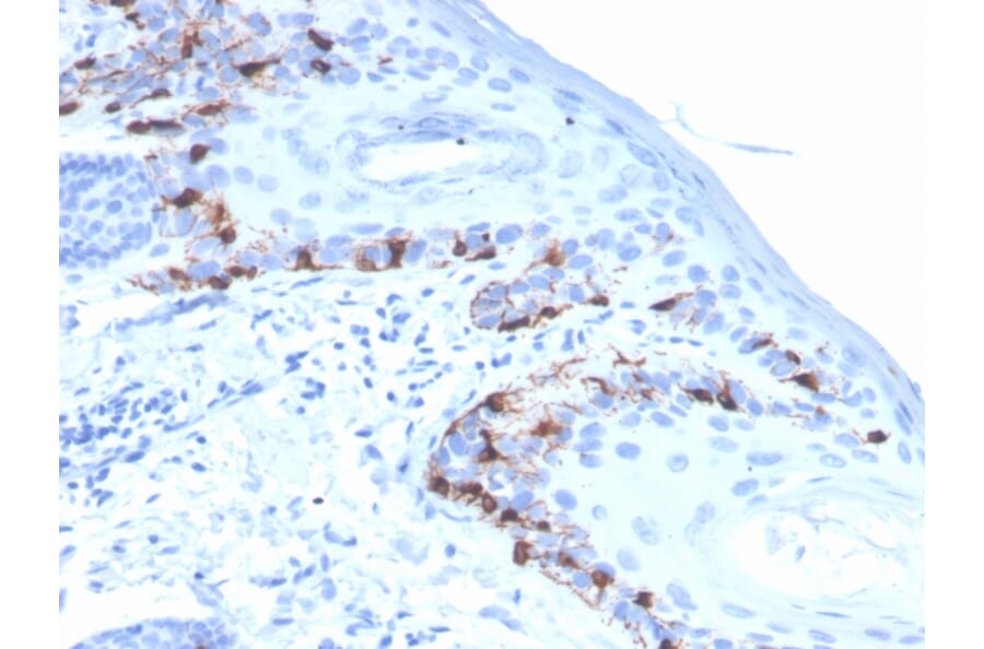 Immunohistochemistry - Anti-MelanA Antibody [rMLANA/4576] - BSA and Azide free (A251735) - Antibodies.com