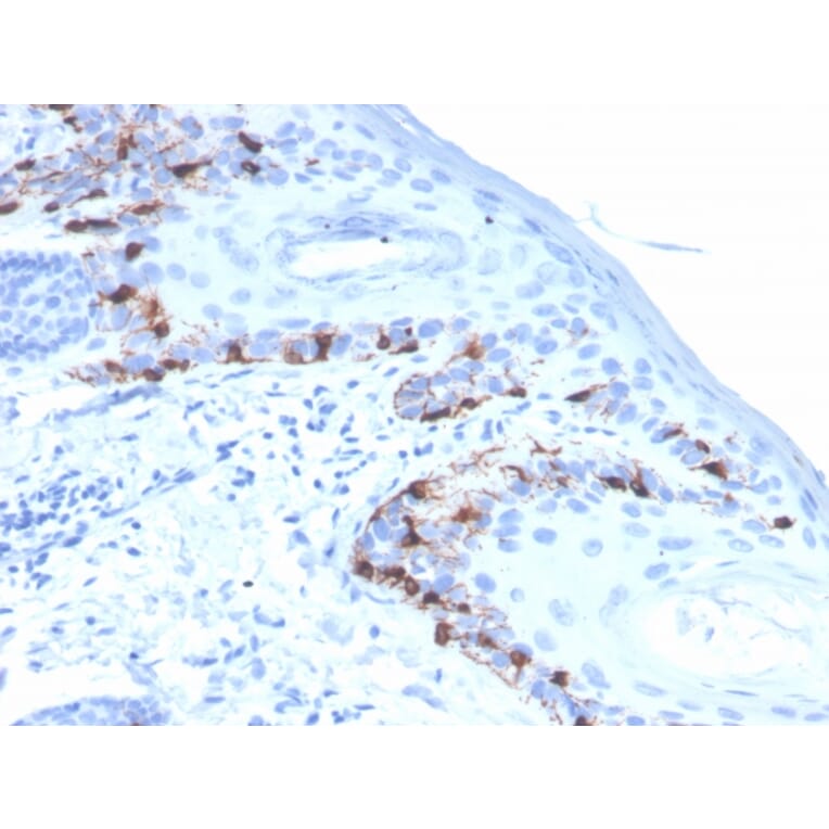 Immunohistochemistry - Anti-MelanA Antibody [rMLANA/4576] - BSA and Azide free (A251735) - Antibodies.com