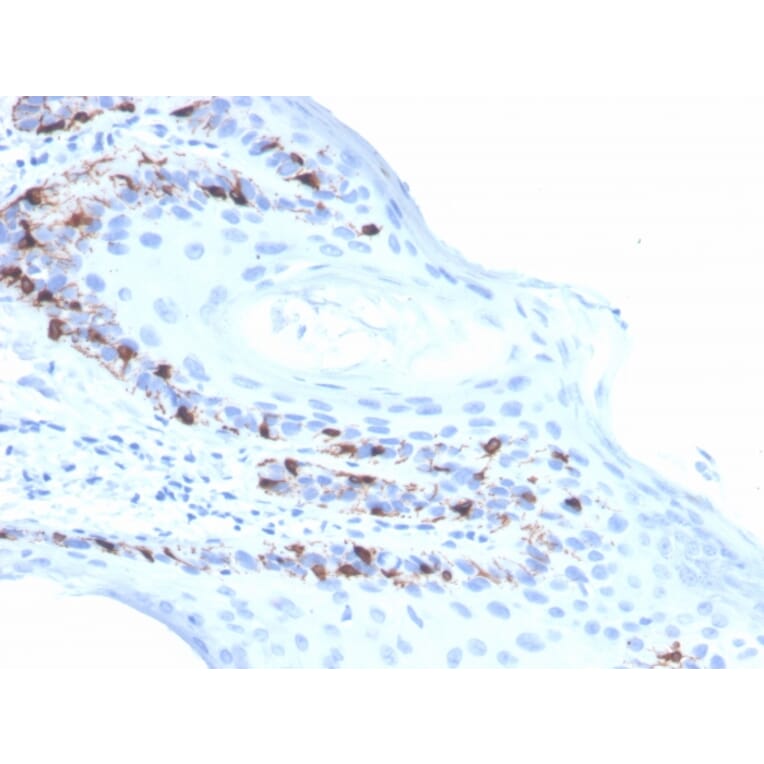 Immunohistochemistry - Anti-MelanA Antibody [rMLANA/4576] - BSA and Azide free (A248553) - Antibodies.com