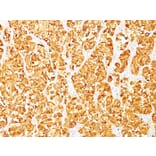 Immunohistochemistry - Anti-MelanA Antibody [M2-7C10] - BSA and Azide free (A251736) - Antibodies.com