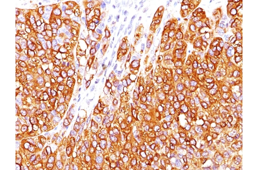Immunohistochemistry - Anti-MelanA Antibody [M2-7C10] - BSA and Azide free (A251735) - Antibodies.com
