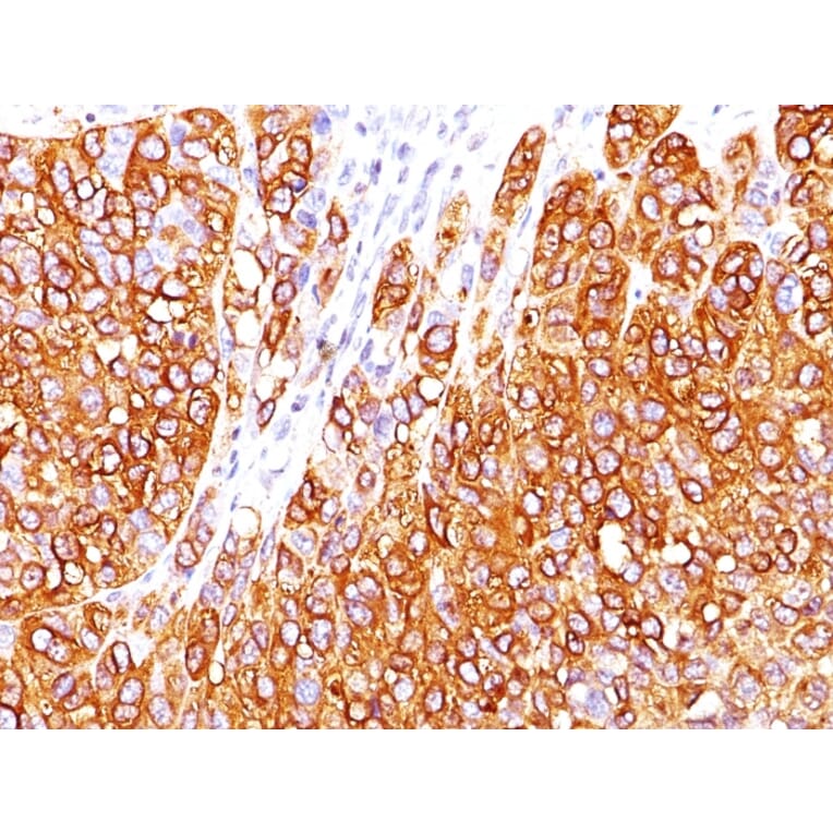 Immunohistochemistry - Anti-MelanA Antibody [M2-7C10] - BSA and Azide free (A251735) - Antibodies.com