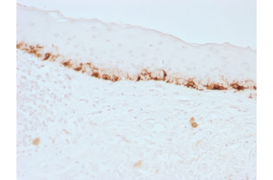 Immunohistochemistry - Anti-MelanA Antibody [M2-7C10] - BSA and Azide free (A251736) - Antibodies.com