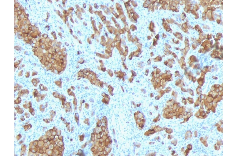 Immunohistochemistry - Anti-MelanA Antibody [SPM342] - BSA and Azide free (A251736) - Antibodies.com