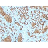 Immunohistochemistry - Anti-MelanA Antibody [SPM342] - BSA and Azide free (A251736) - Antibodies.com
