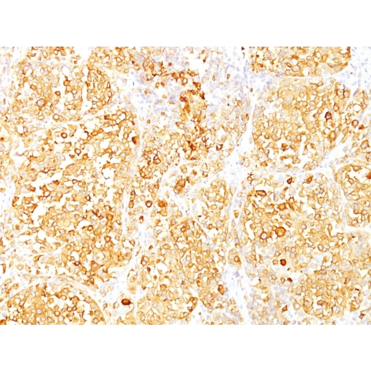 Immunohistochemistry - Anti-MelanA Antibody [M2-9E3] - BSA and Azide free (A251738) - Antibodies.com