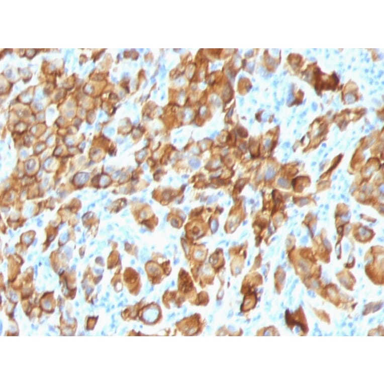 Immunohistochemistry - Anti-MelanA Antibody [SPM540] - BSA and Azide free (A251738) - Antibodies.com